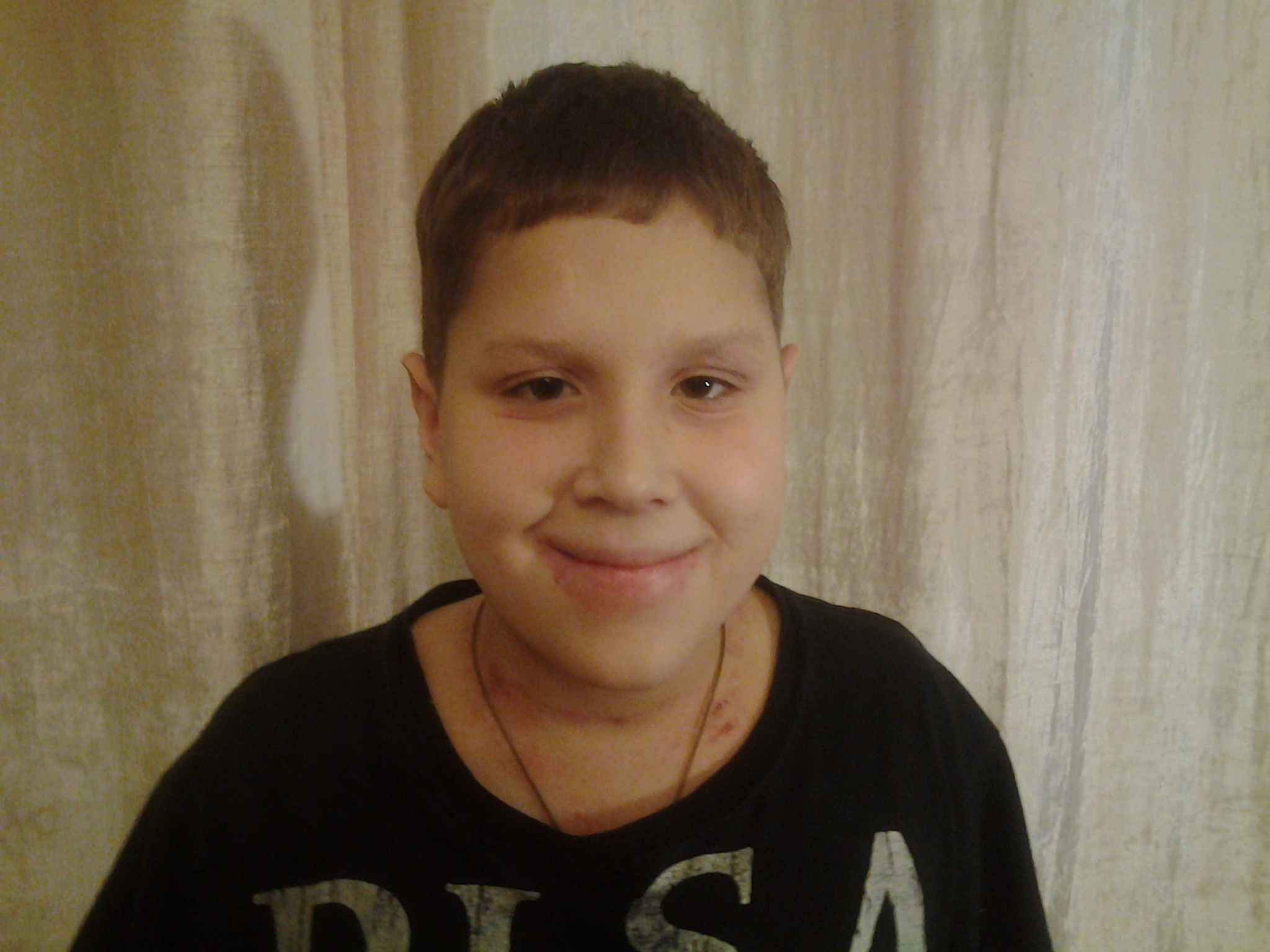 Вы оплатили лечение челюстной патологии для Вани Шумилова