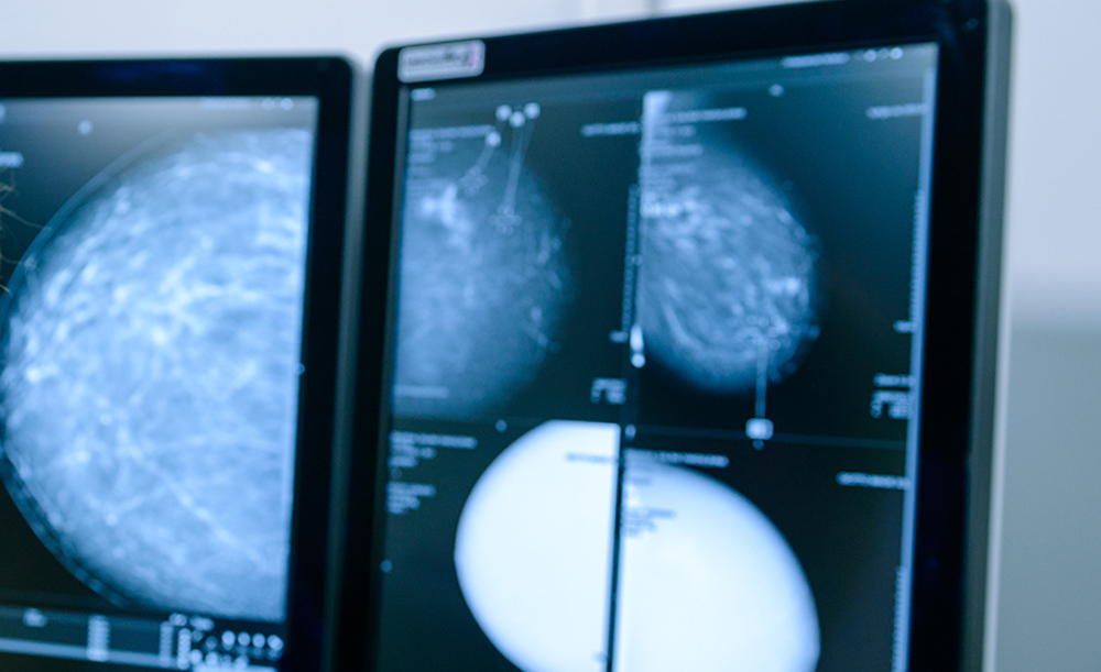 Инструкция по получению высокотехнологичной медицинской помощь по ОМС