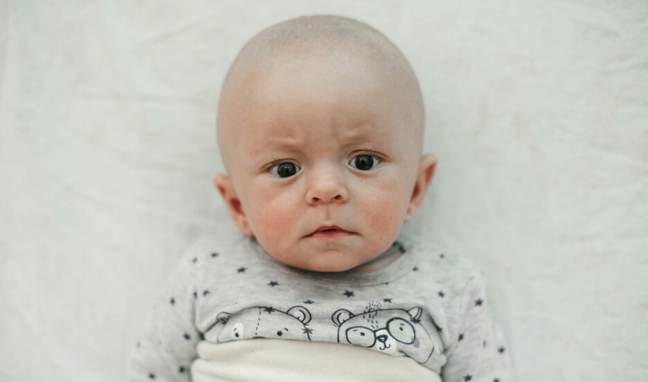 У малыша не проходит странная желтуха, нужен генетический анализ