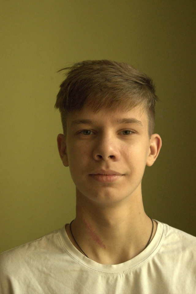 Семен Масленников. У Семена точечный кератоз и атопический дерматит ...