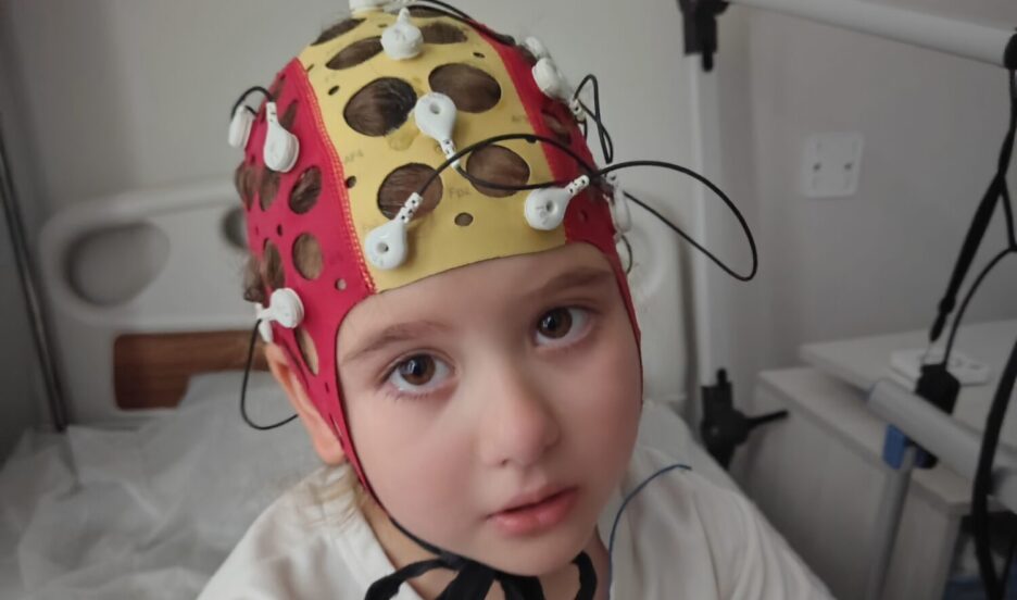 Необходимо секвенирование по методу Сэнгера для уточнения генетического диагноза 