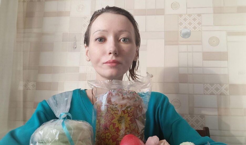 Девушке нужен экзоскелет, чтобы сохранить подвижность рук